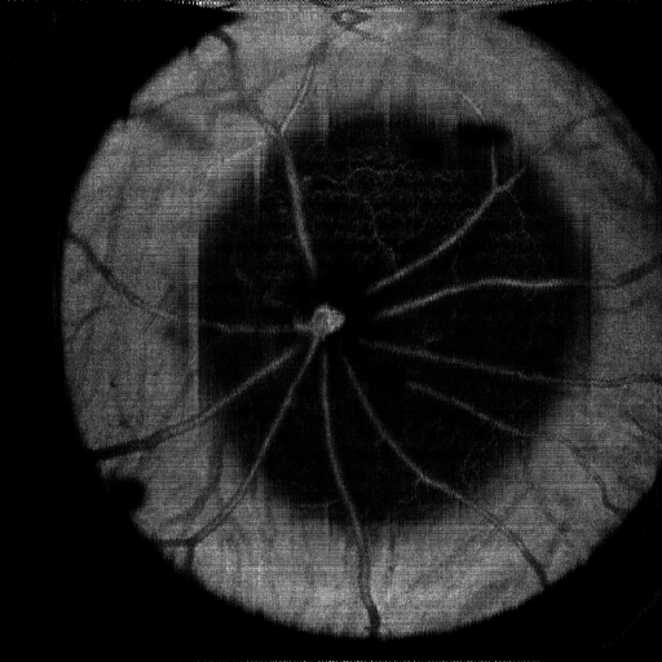 Inferred image example vascular map